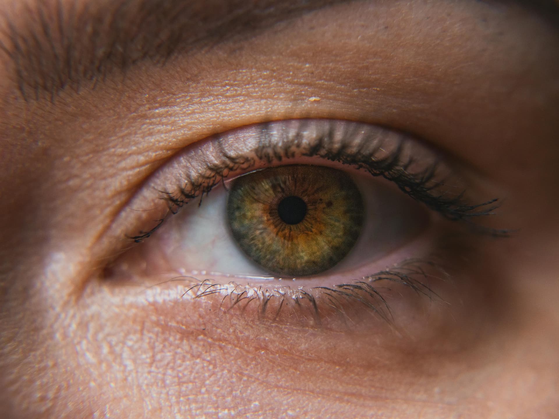 Close-up of an eye, representing blepharitis and eyelid care.